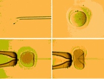在荆州做一次试管婴儿需要准备多少钱？做三代试管推荐哪些医院