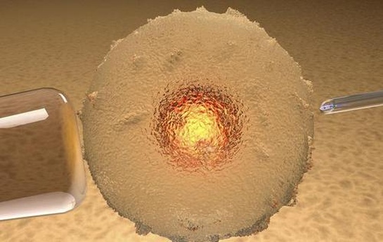 美国单身做试管婴儿贵吗？美国单身做试管婴儿费用